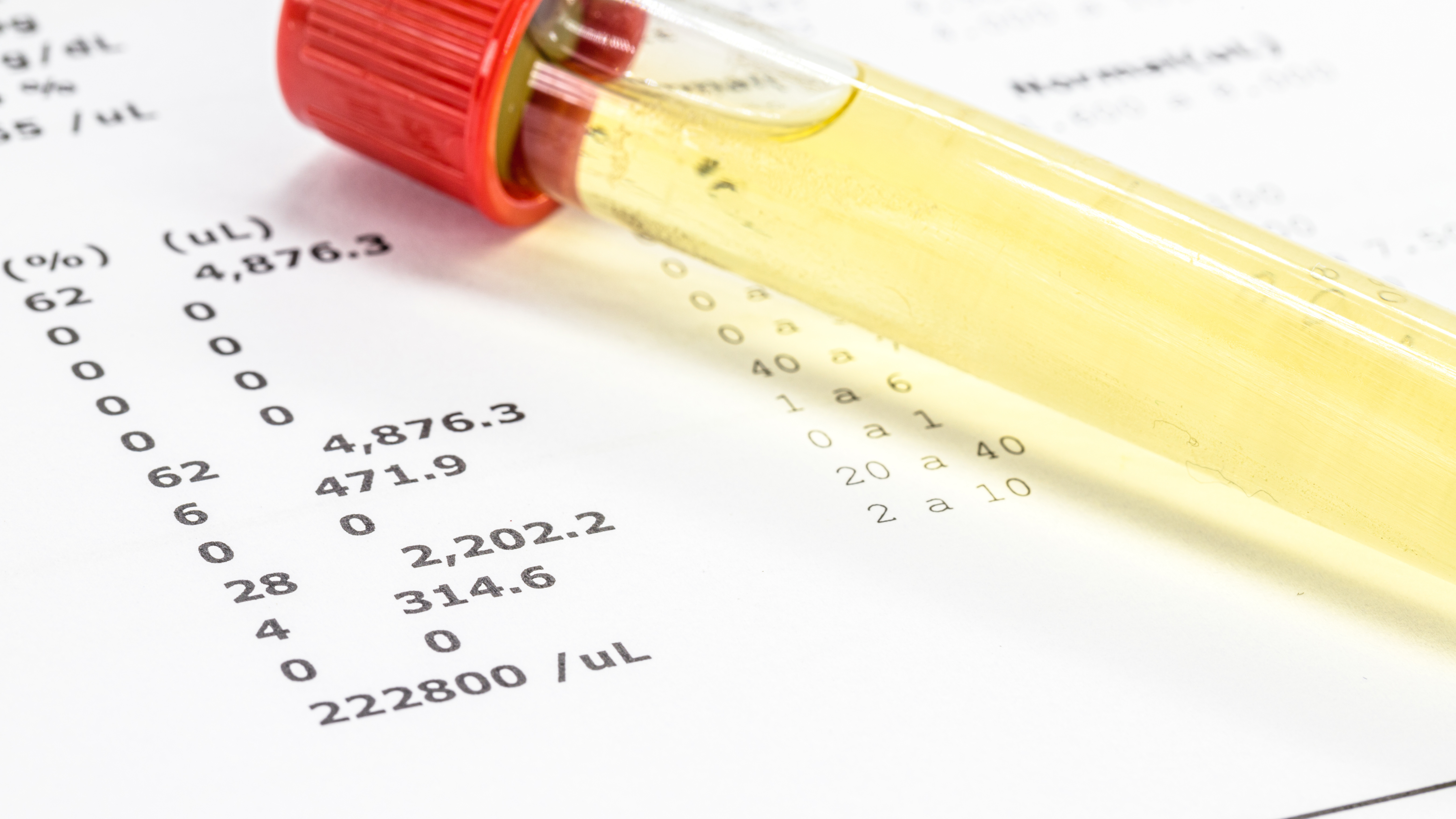 Comprar exame toxicológico para CNH: sua jornada rumo à habilitação descomplicada!