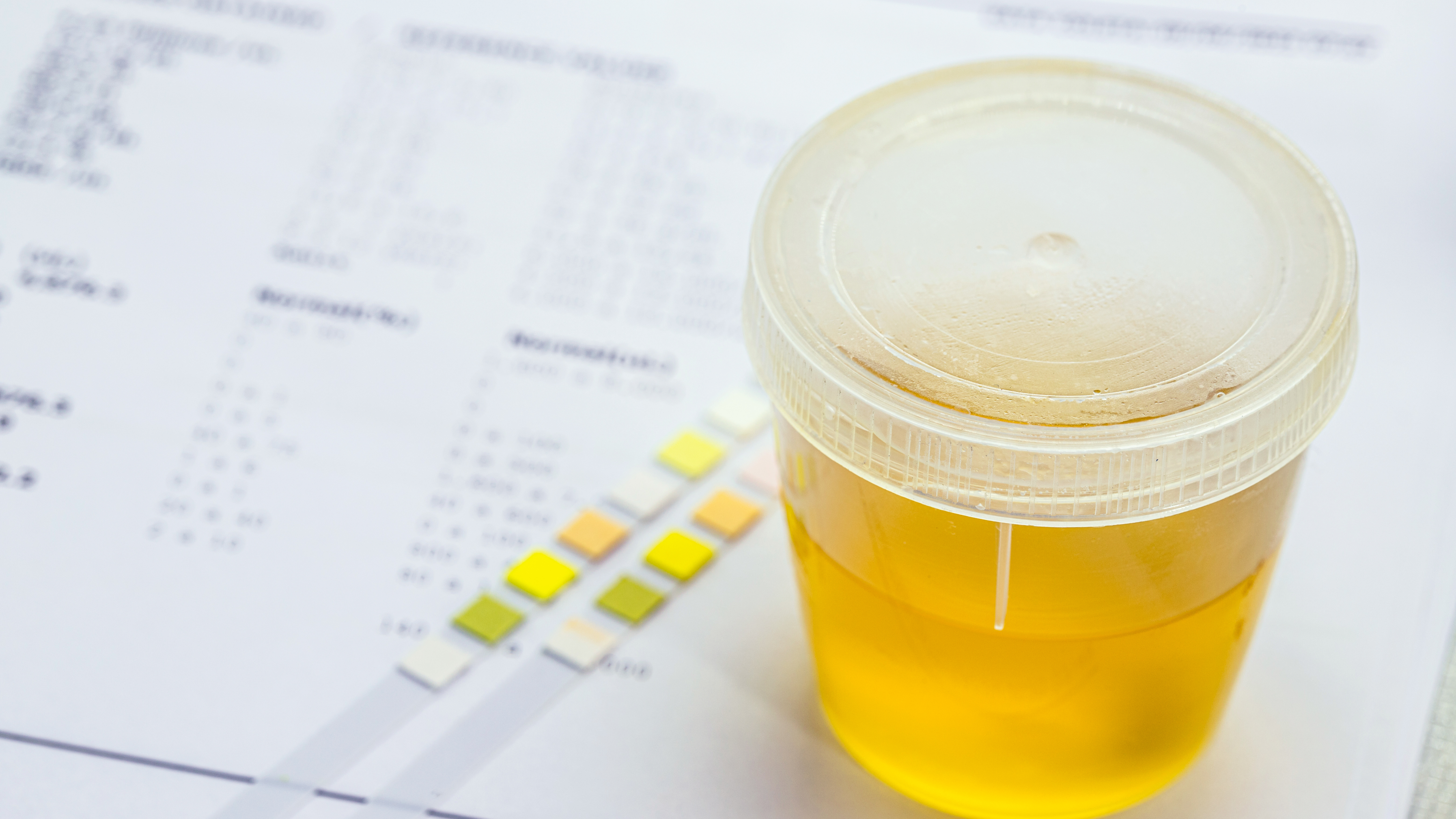 Comprar exame toxicológico para CNH